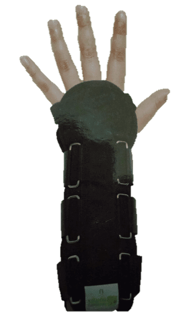 Férula para Muñeca y Antebrazo Universal - Vista 1